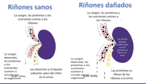 Urea Baja En Sangre Niños Carol Mclean 3692